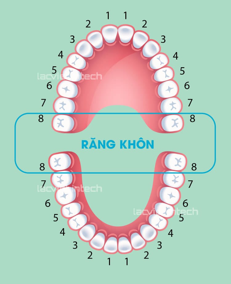 Răng khôn mọc ở đâu? Mọc như thế nào? Mọc răng khôn trong bao lâu?