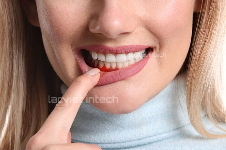 Mất răng và những hậu quả khôn lường