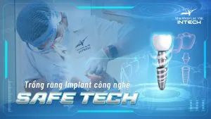 Nha khoa Lạc Việt Intech - Trung tâm trồng răng Implant chuyên sâu - công nghệ trồng răng implant