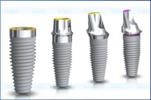 Có rất nhiều loại trụ implant trên thị trường với mức giá khác nhau