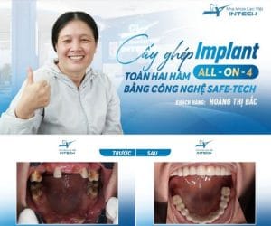 Khai-truong-vinh-tang-goi-tham-kham-3tr