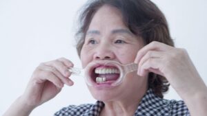 Cô Sinh mất nhiều răng, sử dụng hàm giả tháo lắp nhưng không hiệu quả.