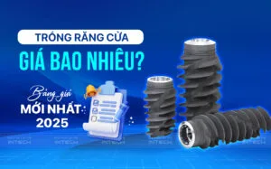 Trồng răng cửa giá bao nhiêu? Bảng giá mới nhất 2025