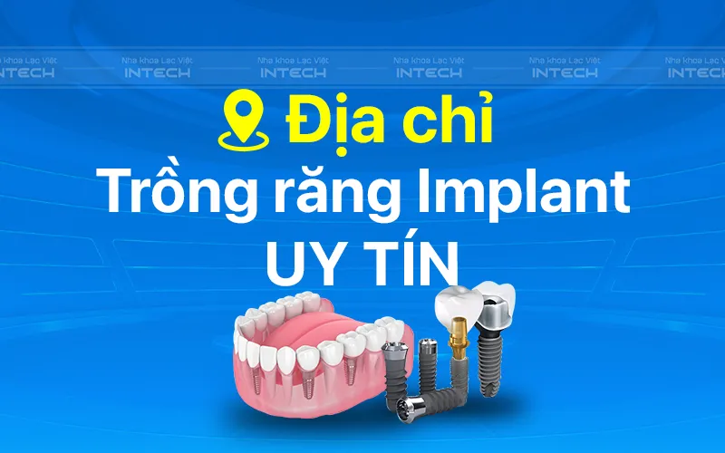 Giá Trồng Răng Cho Người Già - Nha khoa Lạc Việt Intech