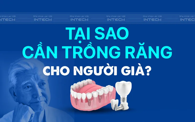Giá Trồng Răng Cho Người Già - Nha khoa Lạc Việt Intech